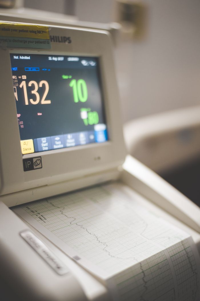 services-01 Close-up view of an ECG monitor displaying patient vitals and printed graphs.